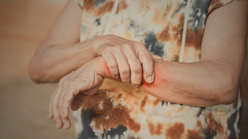 Redlands Retirement community injury lawyers Woman with wrist injury